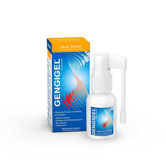 Gengigel pršilo za dlesni, 20 mL