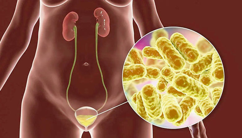Picture of Kateri antibiotik za vnetje mehurja