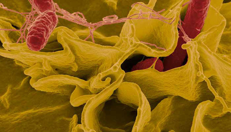 Picture of Salmonela simptomi