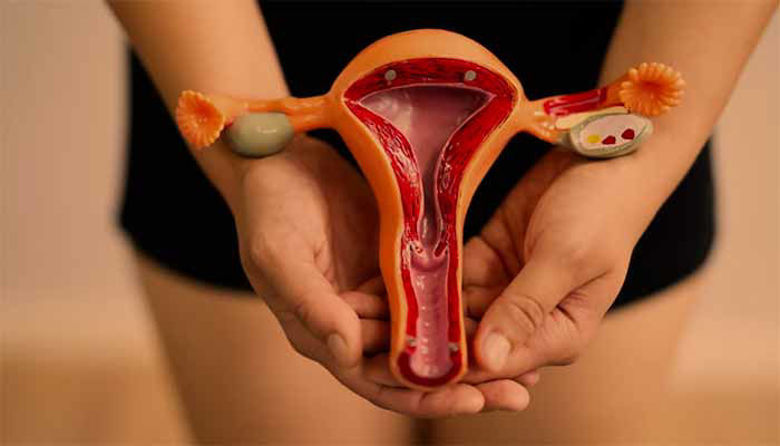 Picture of ENDOMETRIOZA: Simptomi, Vzroki, Zdravljenje!