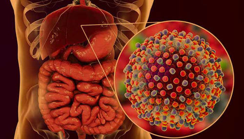 Hepatitis