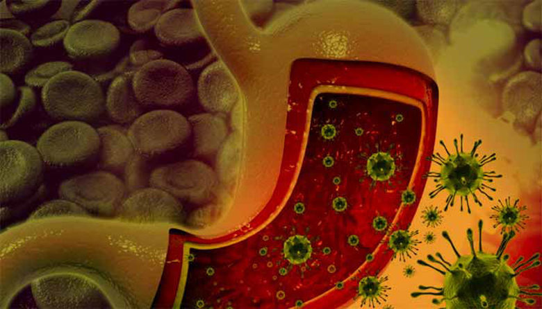 Picture of Gastroenteritis