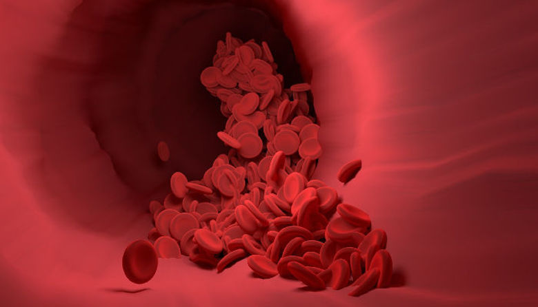 Picture of Ldl holesterol